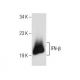 IFN-β Antibody (MIB-3F7.3) - Western Blotting - Image 156198
