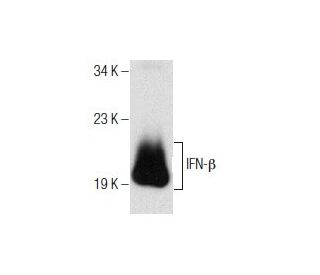 IFN-&beta; Antibody (MIB-8C4.1) - Western Blotting - Image 156199