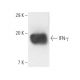 IFN-γ/Interferon gamma Antibody (3F1E3) - Western Blotting - Image 10103