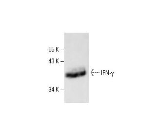 IFN-&gamma;/Interferon gamma Antibody (4S.B3) - Western Blotting - Image 11637