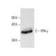 IFN-γ/Interferon gamma Antibody (4S.B3) - Western Blotting - Image 11637