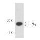 IFN-γ/Interferon gamma Antibody (500-M90) - Western Blotting - Image 18052 
