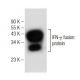 IFN-γ/Interferon gamma Antibody (E-10) - Western Blotting - Image 146558