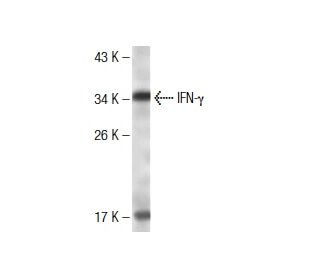 IFN-&gamma;/Interferon gamma Antibody (E8H1) - Western Blotting - Image 137456