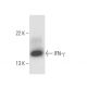 IFN-γ/Interferon gamma Antibody (F3) - Western Blotting - Image 16431