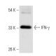 IFN-γ/Interferon gamma Antibody (H3-1) - Western Blotting - Image 17784