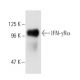 IFN-γRα Antibody (2E2) - Western Blotting - Image 2963