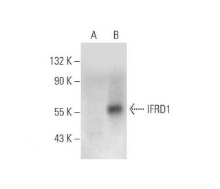 IFRD1 Antibody (D-7) - Western Blotting - Image 333712Each CRISPR/Cas9 Knockout (KO) Plasmid product consists of a pool of 3 plasmids designed to ensure identification and cleavage of a specific gene for maximum knockout efficiency. Each plasmid encodes a unique 20 nt sequence derived from the GeCKO (v2) library. 