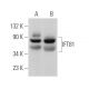 IFT81 Antibody (A-3) - Western Blotting - Image 367536