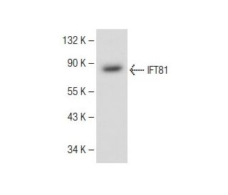 IFT81 Antibody (B-1) - Western Blotting - Image 149467 