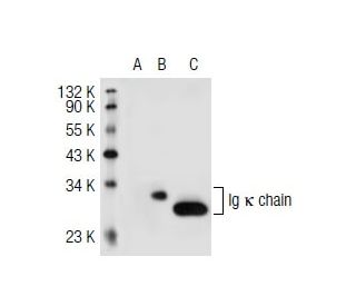 Ig &kappa; chain Antibody (MEM-09) - Western Blotting - Image 40631 