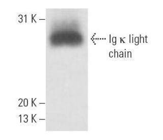 Ig &kappa; chain Antibody (OX11) - Western Blotting - Image 15506