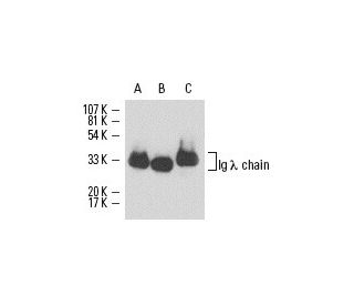 Ig &lambda; chain Antibody (N10/2) - Western Blotting - Image 16438 