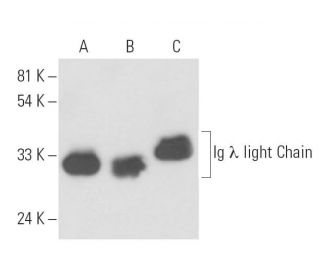 Ig &lambda; light chain Antibody (ICO106) - Western Blotting - Image 16439 