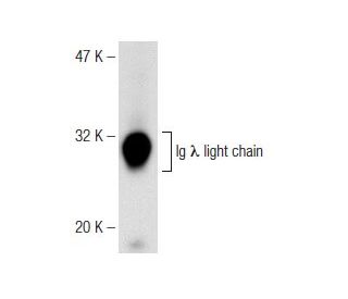 Ig &lambda; light chain Antibody (JDC-12) - Western Blotting - Image 141638 