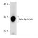 Ig λ light chain Antibody (JDC-12) - Western Blotting - Image 141638 