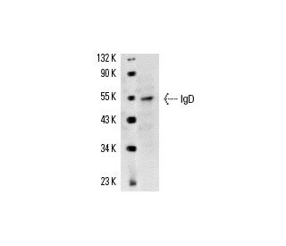 IgD Antibody (AMS 9.1) - Western Blotting - Image 14646