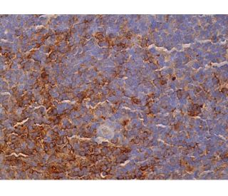 IgD Antibody (OX60) - Immunohistochemistry - Image 386308 