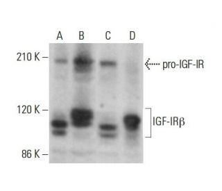 IGF-1 Receptor β/IGF1R Antibody (F-1) - Western Blotting - Image 352078