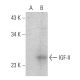 IGF-II Antibody (H-11) - Western Blotting - Image 364978