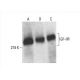 IGF2R/M6PR Antibody (29) - Western Blotting - Image 392957 