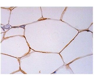 IGF-1 Receptor &alpha;/IGF1R Antibody (1H7) - Immunohistochemistry - Image 293981 