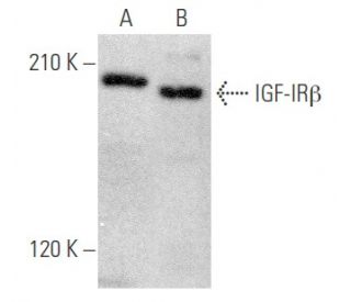 IGF-1 Receptor &beta;/IGF1R Antibody (T8C8) - Western Blotting - Image 354061 