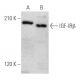IGF-1 Receptor β/IGF1R Antibody (T8C8) - Western Blotting - Image 354061 
