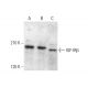 IGF-1 Receptor β/IGF1R Antibody (T8C8) - Western Blotting - Image 376744