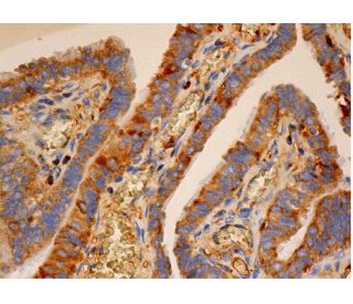 IGF2BP2 Antibody (F-12) - Immunohistochemistry - Image 286498 