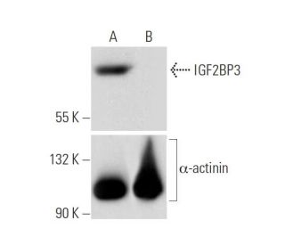 IGF2BP3 HDR Plasmid (h): sc-402603-HDR. Western blot analysis of IGF2BP3... 