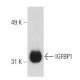 IGFBP1 Antibody (H-3) - Western Blotting - Image 2512