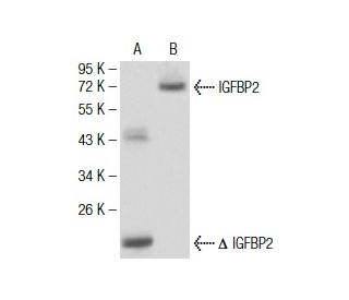IGFBP2 Antibody (1F6F6) - Western Blotting - Image 137476 