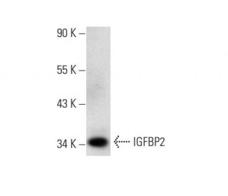 IGFBP2 Antibody (G-1) - Western Blotting - Image 139171