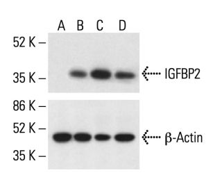 IGFBP2 Antibody (1F6F6) - Western Blotting - Image 411762