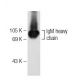 IgM Antibody (2C12-3) - Western Blotting - Image 108982