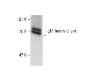 IgM Antibody (M11) - Western Blotting - Image 139197 