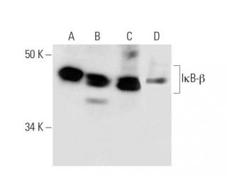 I&kappa;B-&beta; Antibody (F-9) - Western Blotting - Image 289011 