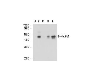 I&kappa;B-&beta; Antibody (G-6) - Western Blotting - Image 17298 