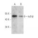 IκB-β Antibody (G-6) - Western Blotting - Image 356938