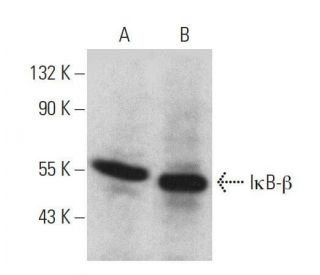 I&kappa;B-&beta; Antibody (H-3) - Western Blotting - Image 358544