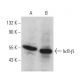 IκB-β Antibody (H-3) - Western Blotting - Image 358544