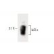 IκB-ε Antibody (21) - Western Blotting - Image 60323 