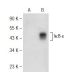 IκB-ε Antibody (E-9) - Western Blotting - Image 148991