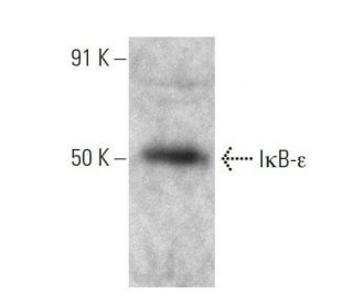 I&kappa;B-&epsilon; Antibody (E-9) - Western Blotting - Image 358588 