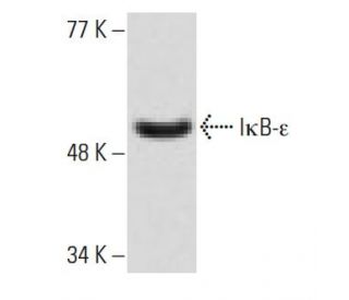 I&kappa;B-&epsilon; Antibody (G-4) - Western Blotting - Image 1071