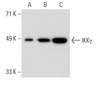 IKK&gamma; Antibody (72C627) - Western Blotting - Image 36840 