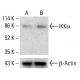 IKK alpha Antibody (14A231) - Western Blotting - Image 412582