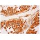 IKK alpha Antibody (D-5) - Immunohistochemistry - Image 310489