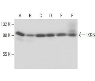 IKK&beta; Antibody (10A9B6) - Western Blotting - Image 17433